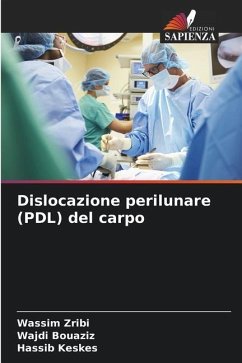 Dislocazione perilunare (PDL) del carpo - Zribi, Wassim;Bouaziz, Wajdi;Keskes, Hassib