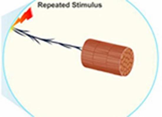 Genesis of Tetanus (eBook, ePUB)