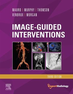 Image-Guided Interventions E-Book (eBook, ePUB) - Thomson MD, Franzcr