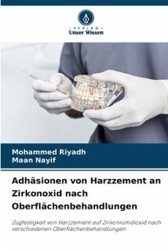 Adhäsionen von Harzzement an Zirkonoxid nach Oberflächenbehandlungen - Riyadh, Mohammed;Nayif, Maan