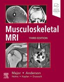 Musculoskeletal MRI E-Book (eBook, ePUB)