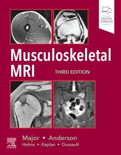 Cover Musculoskeletal MRI E-Book (eBook, ePUB)