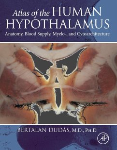 Atlas of the Human Hypothalamus (eBook, ePUB) - Dudas, Bertalan