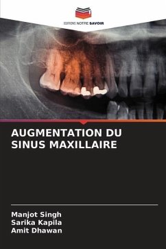 AUGMENTATION DU SINUS MAXILLAIRE - Singh, Manjot;Kapila, Sarika;Dhawan, Amit