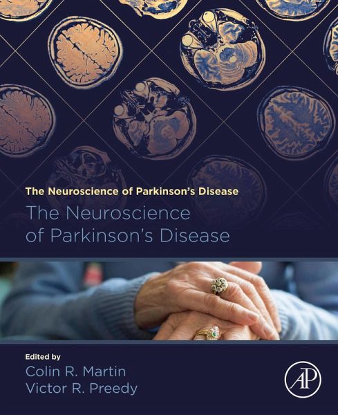 The Neuroscience of Parkinson's Disease (eBook, ePUB)