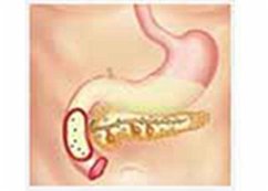 Pancreatic Function Test Part 1 (eBook, ePUB) - Mahto, Mala