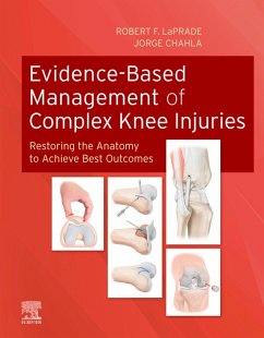 Cover Evidence-Based Management of Complex Knee Injuries E-Book (eBook, ePUB)