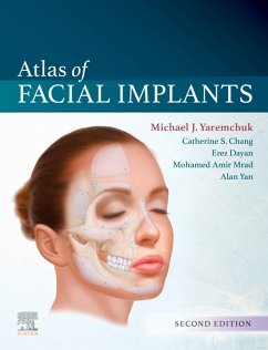 Atlas of Facial Implants (eBook, ePUB) - Yaremchuk, Michael J.