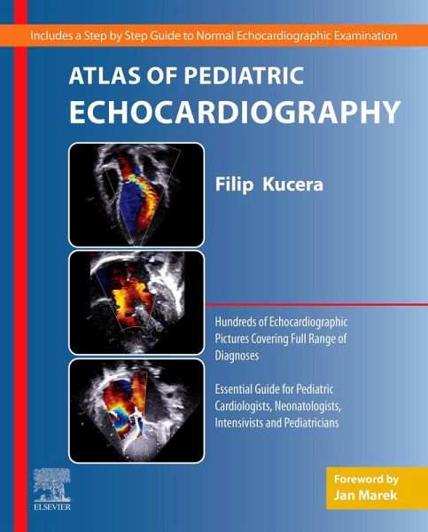 Atlas of Pediatric Echocardiography (eBook, ePUB) Atlas of Pediatric Echocardiography (eBook, ePUB)