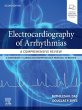 Electrocardiography of Arrhythmias: A... - Bild 1