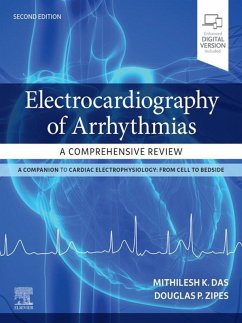 Electrocardiography of Arrhythmias: A Comprehensive Review E-Book (eBook, ePUB) - Das, Mithilesh Kumar; Zipes, Douglas P.