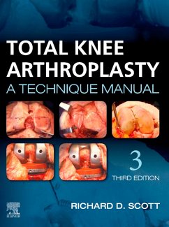 Total Knee Arthroplasty E-Book (eBook, ePUB) - Scott, Richard D.