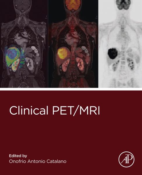 Clinical PET/MRI (eBook, ePUB)