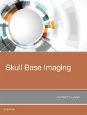 Skull Base Imaging (eBook, ePUB) Skull Base Imaging (eBook, ePUB)