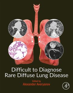 Cover Difficult to Diagnose Rare Diffuse Lung Disease (eBook, ePUB)
