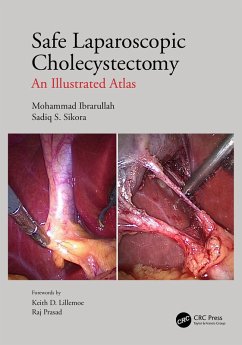 Safe Laparoscopic Cholecystectomy (eBook, ePUB) - Ibrarullah, Mohammad; Sikora, Sadiq S