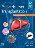 Pediatric Liver Transplantation (eBook, ePUB)
