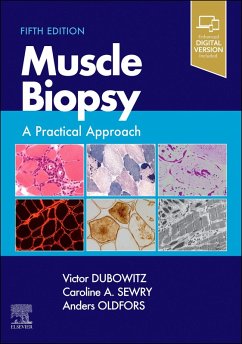 Muscle Biopsy E-Book (eBook, ePUB) - Dubowitz, Victor; Sewry, Caroline A.; Oldfors, Anders