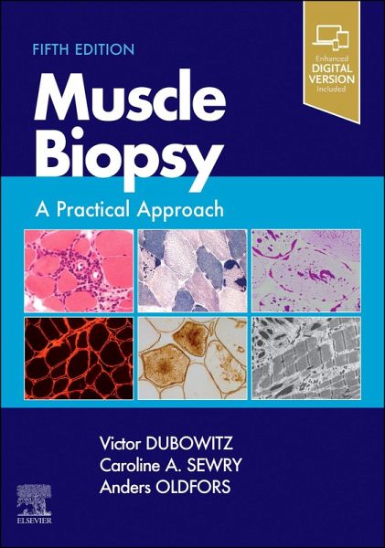 Muscle Biopsy E-Book (eBook, PDF)