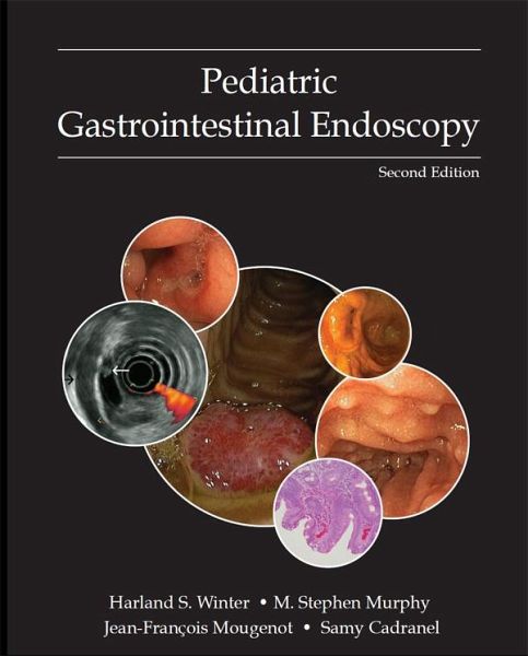 Pediatric Gastrointestinal Endoscopy (eBook, ePUB) Pediatric Gastrointestinal Endoscopy (eBook, ePUB)