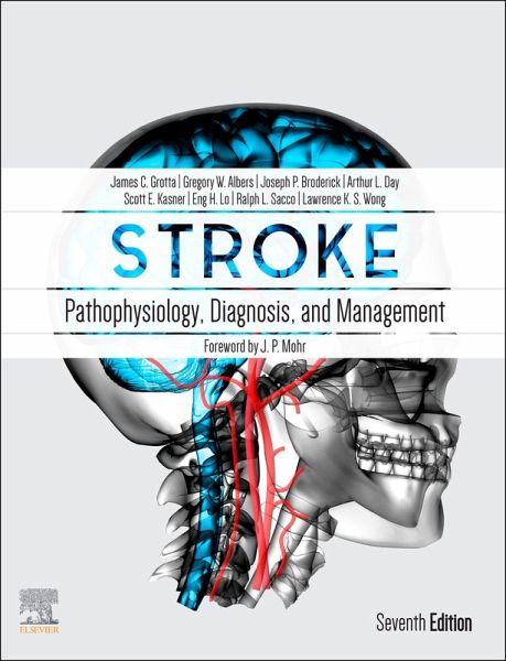 Stroke E-Book (eBook, ePUB)