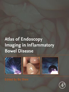 Cover Atlas of Endoscopy Imaging in Inflammatory Bowel Disease (eBook, ePUB)