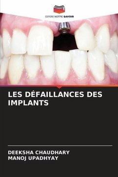 LES DÉFAILLANCES DES IMPLANTS - Chaudhary, Deeksha;Upadhyay, Manoj