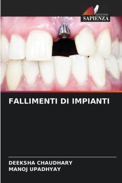 FALLIMENTI DI IMPIANTI - Chaudhary, Deeksha;Upadhyay, Manoj