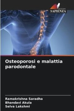 Osteoporosi e malattia parodontale - Saradha, Ramakrishna;Akula, Bhandavi;Lakshmi, Selva