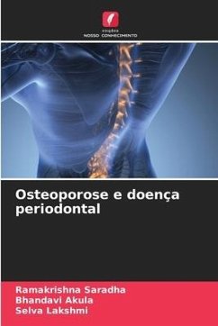 Osteoporose e doença periodontal - Saradha, Ramakrishna;Akula, Bhandavi;Lakshmi, Selva