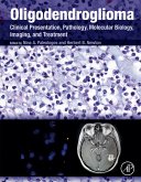 Oligodendroglioma (eBook, ePUB)