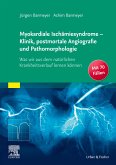 Die myokardialen Ischämiesyndrome - Klinik und postmortale Pathomorphologie (eBook, ePUB)