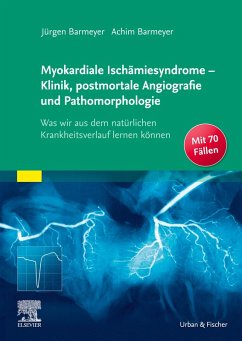 Cover Die myokardialen Ischämiesyndrome - Klinik und postmortale Pathomorphologie (eBook, ePUB)