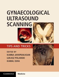 Gynaecological Ultrasound Scanning (eBook, ePUB) Cover Gynaecological Ultrasound Scanning (eBook, ePUB)