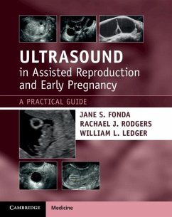 Ultrasound in Assisted Reproduction and Early Pregnancy (eBook, ePUB) - Fonda, Jane S.