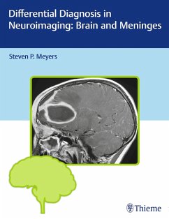 Cover Differential Diagnosis in Neuroimaging: Brain and Meninges (eBook, ePUB)