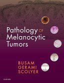 Pathology of Melanocytic Tumors E-Book (eBook, ePUB)