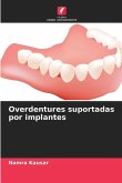 Overdentures suportadas por implantes