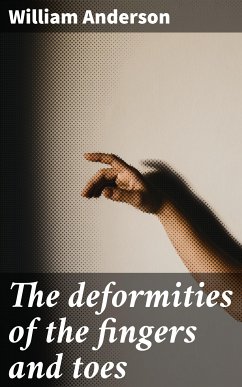 The deformities of the fingers and toes (eBook, ePUB) - Anderson, William