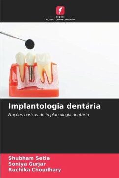 Implantologia dentária - Setia, Shubham;Gurjar, Soniya;Choudhary, Ruchika