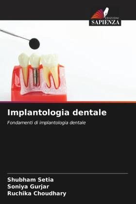 Implantologia dentale Implantologia dentale