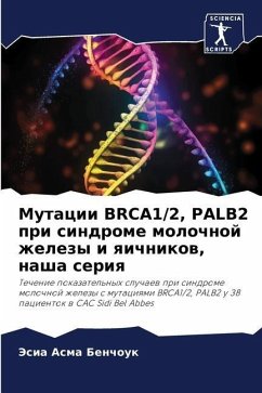 Mutacii BRCA1/2, PALB2 pri sindrome molochnoj zhelezy i qichnikow, nasha seriq - BENCHOUK, Jesia Asma