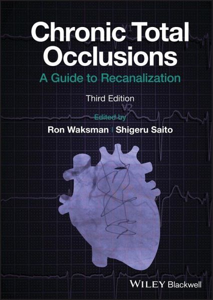 Chronic Total Occlusions (eBook, PDF) Chronic Total Occlusions (eBook, PDF)