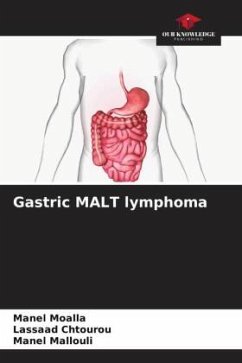 Gastric MALT lymphoma - MOALLA, Manel;Chtourou, Lassaad;Mallouli, Manel