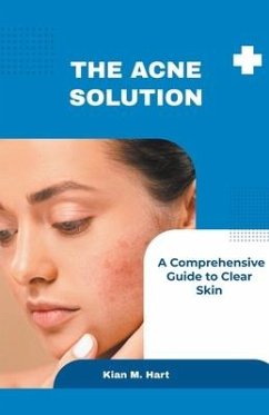 The Acne Solution - Hart, Kian M