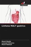 Linfoma MALT gastrico