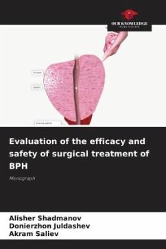 Evaluation of the efficacy and safety of surgical treatment of BPH - Shadmanov, Alisher;Juldashev, Donierzhon;Saliev, Akram