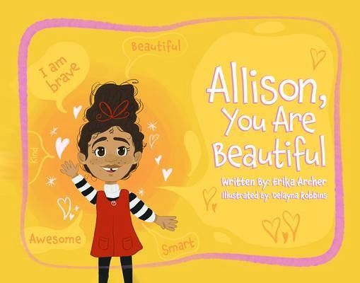 Allison, You Are Beautiful (eBook, ePUB) Allison, You Are Beautiful (eBook, ePUB)
