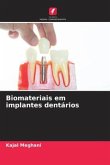 Biomateriais em implantes dentários