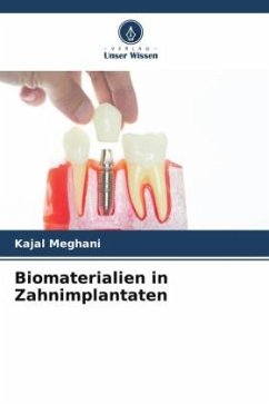 Biomaterialien in Zahnimplantaten - MEGHANI, KAJAL
